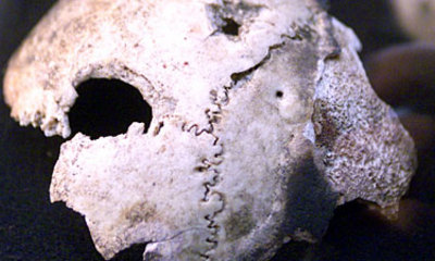 skull